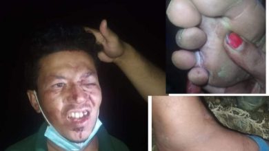 Photo of एम्बुलेन्स चालक माथी स्थानीय युवाद्वारा कुटपिट ।